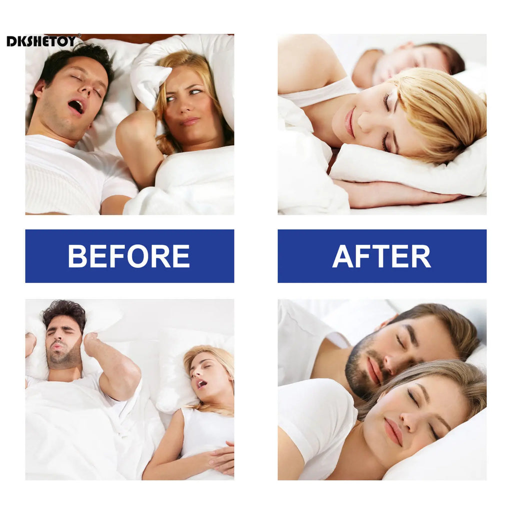 Sleep Mouth Tape Strips — Nose Breathing, Deeper Sleep, Less Snoring | 30 Night Supply